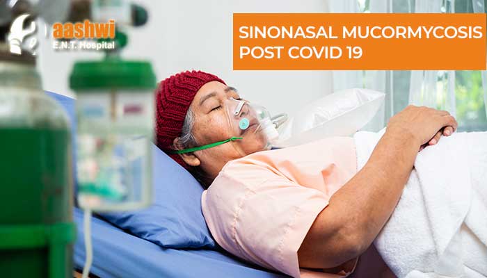 SINONASAL MUCORMYCOSIS POST COVID 19 - Aashwi E.N.T Hospital