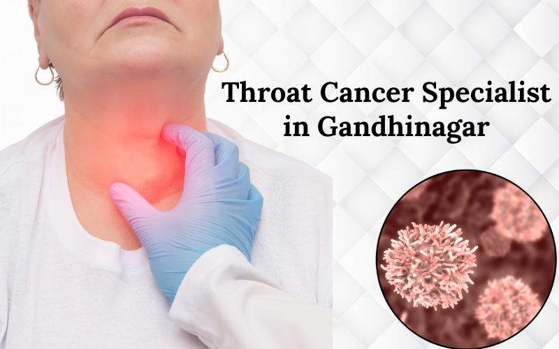 Throat Cancer Specialist in Gandhinagar