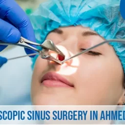 Endoscopic Sinus Surgery in Ahmedabad