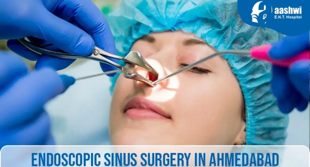 Endoscopic Sinus Surgery in Ahmedabad