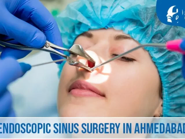 Endoscopic Sinus Surgery in Ahmedabad