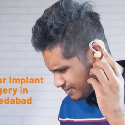 Cochlear Implant Surgery in Ahmedabad