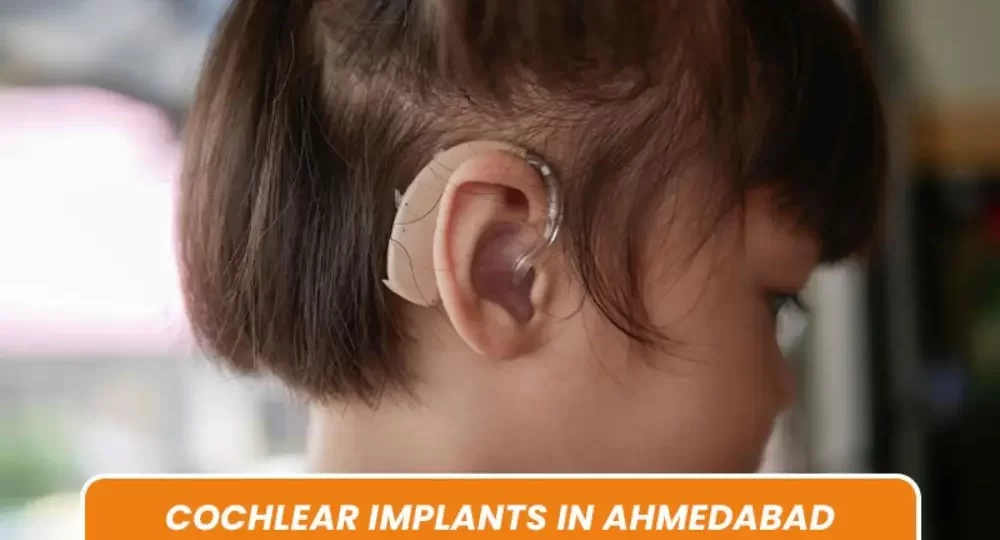 Cochlear Implants in Ahmedabad