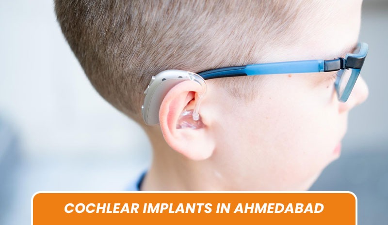 Cochlear Implants in Ahmedabad