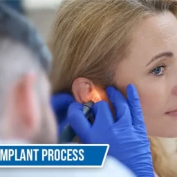 Cochlear Implant Process