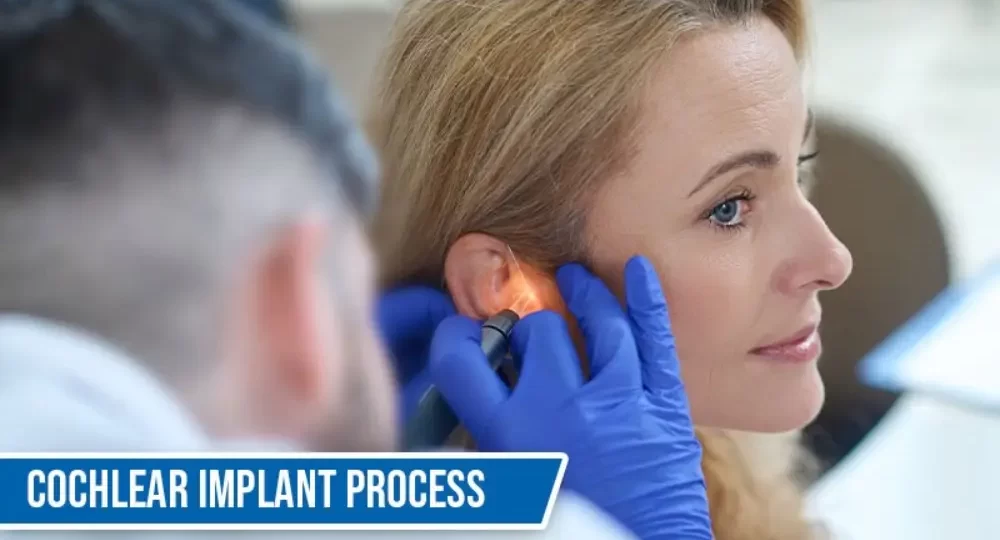 Cochlear Implant Process