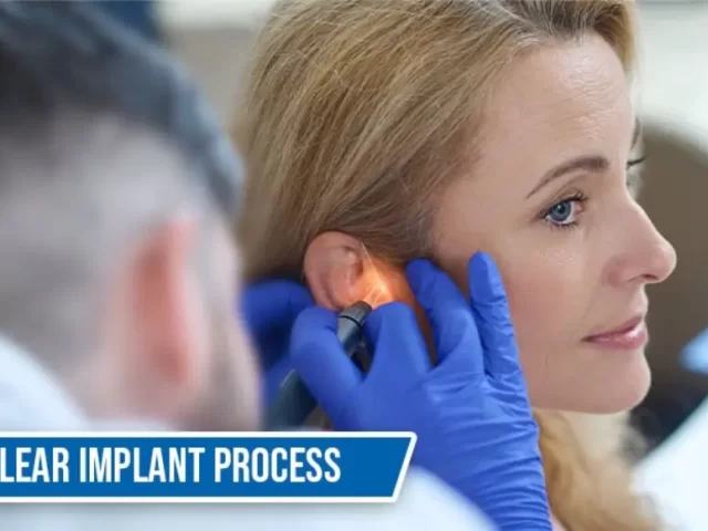 Cochlear Implant Process