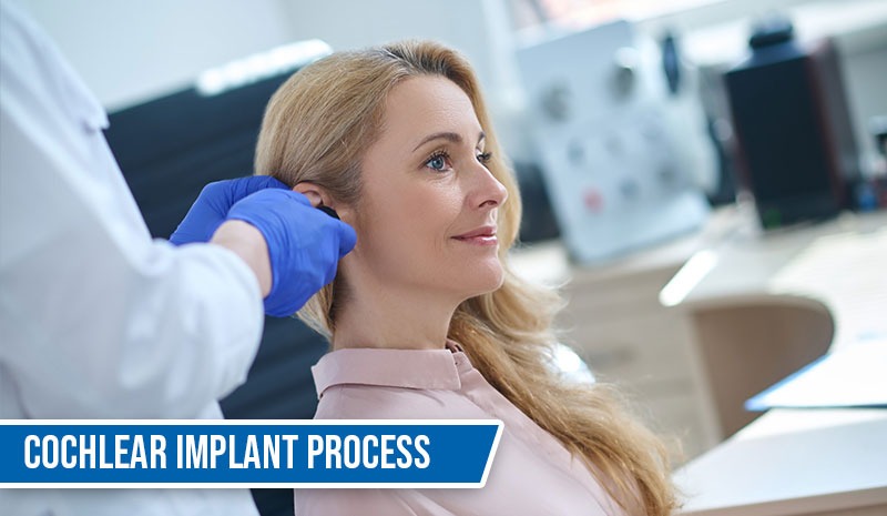 Cochlear Implant Process