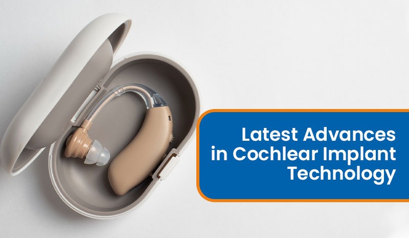 Latest Advances in Cochlear Implant Technology