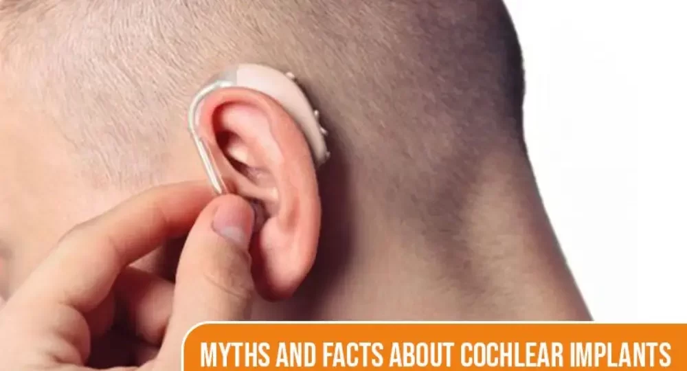 Myths and facts about cochlear implants