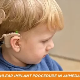 Cochlear Implant Procedure in Ahmedabad