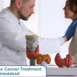 Larynx Cancer Treatment in Ahmedabad