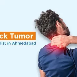Neck Tumor Specialist in Ahmedabad