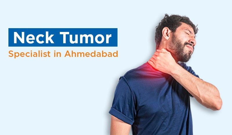 Neck Tumor Specialist in Ahmedabad