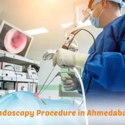 Endoscopy Procedure in Ahmedabad
