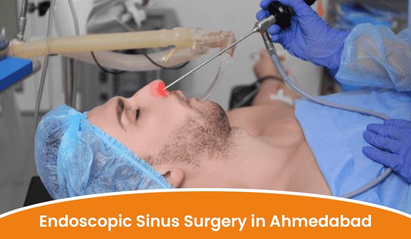 Endoscopic Sinus Surgery in Ahmedabad | Aashwi ENT Hospital