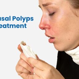 Nasal Polyps Treatment